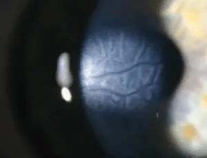 Fig D