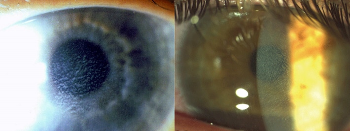 Fig C